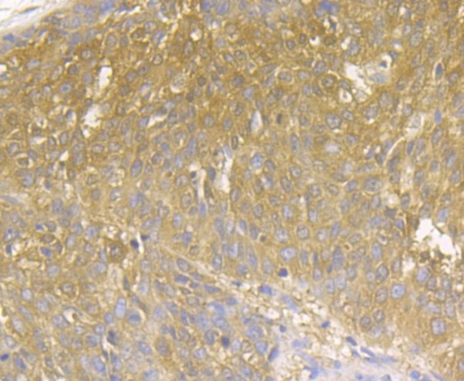 MICA/B Polyclonal Antibody (PA5-109323)