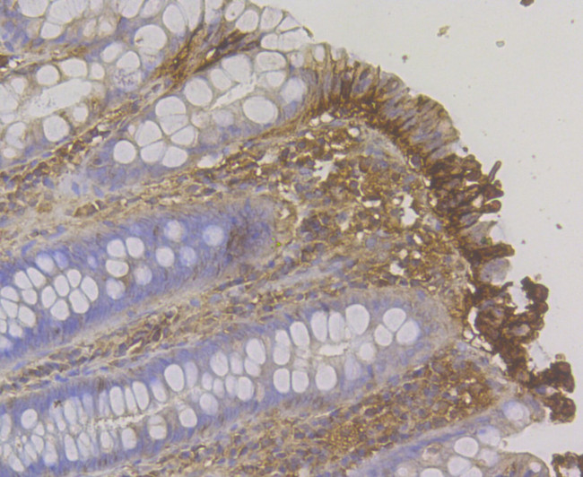 CDH17 Antibody in Immunohistochemistry (Paraffin) (IHC (P))