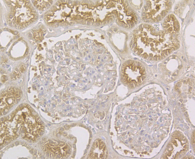 STIM2 Antibody in Immunohistochemistry (Paraffin) (IHC (P))