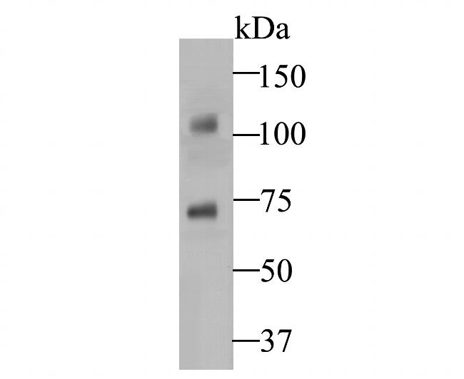 STIM2 Antibody in Western Blot (WB)