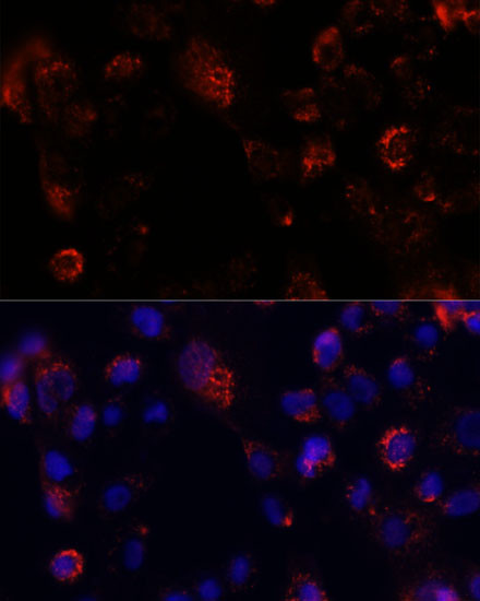 ACOT9 Antibody in Immunocytochemistry (ICC/IF)