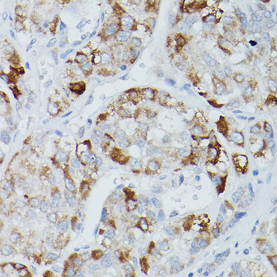 ALPL Antibody in Immunohistochemistry (Paraffin) (IHC (P))