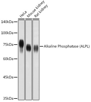 ALPL Antibody in Western Blot (WB)