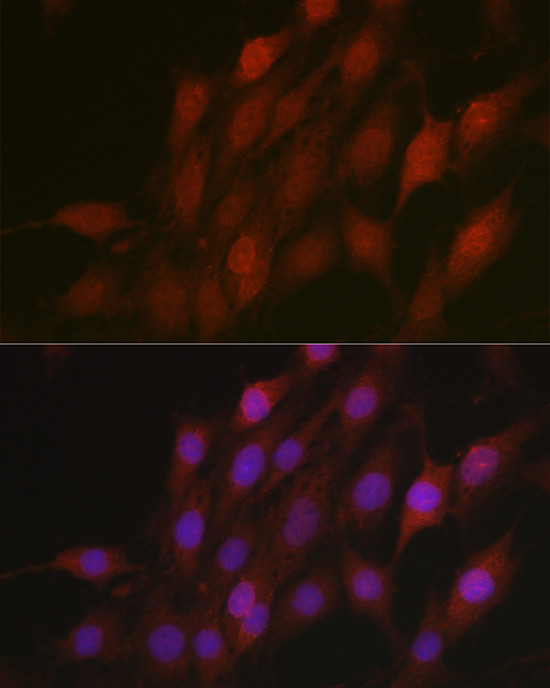 BTRC Antibody in Immunocytochemistry (ICC/IF)