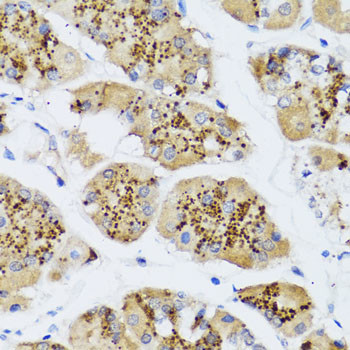 CHIC2 Antibody in Immunohistochemistry (Paraffin) (IHC (P))