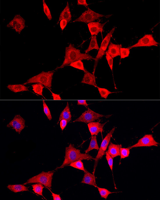 CYP4V2 Antibody in Immunocytochemistry (ICC/IF)