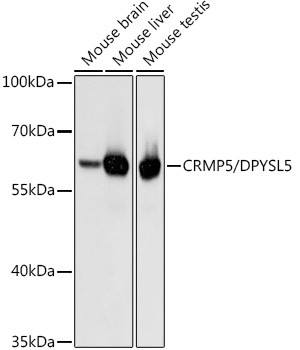 CRMP5 Antibody in Western Blot (WB)