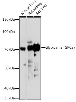 Glypican 3 Antibody in Western Blot (WB)