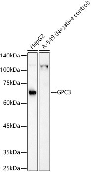 Glypican 3 Antibody in Western Blot (WB)