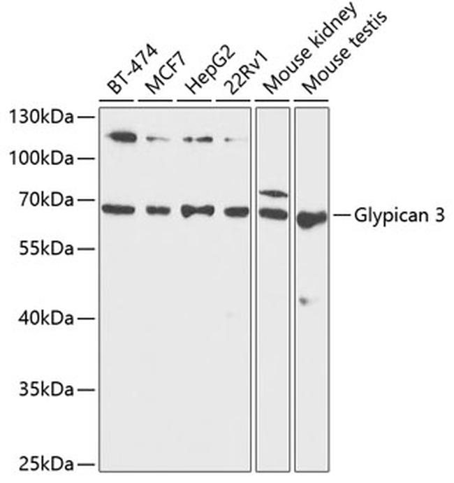 Glypican 3 Polyclonal Antibody (PA5-109771)