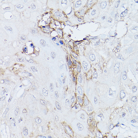 GNA11 Antibody in Immunohistochemistry (Paraffin) (IHC (P))