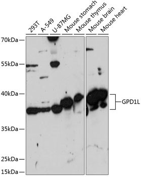 GPD1L Antibody in Western Blot (WB)