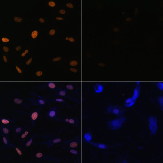 H3K23ac Antibody in Immunocytochemistry (ICC/IF)