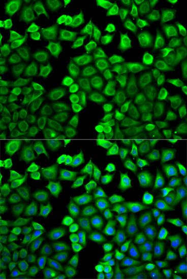 HNMT Antibody in Immunocytochemistry (ICC/IF)