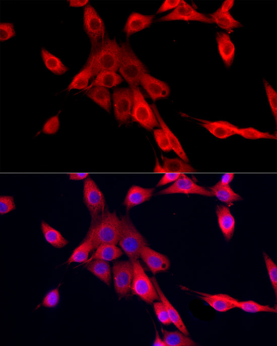 MEIS1 Antibody in Immunocytochemistry (ICC/IF)