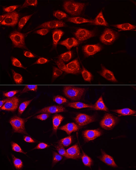 MTTP Antibody in Immunocytochemistry (ICC/IF)