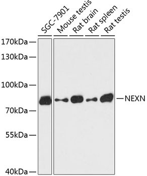 NEXN Antibody in Western Blot (WB)