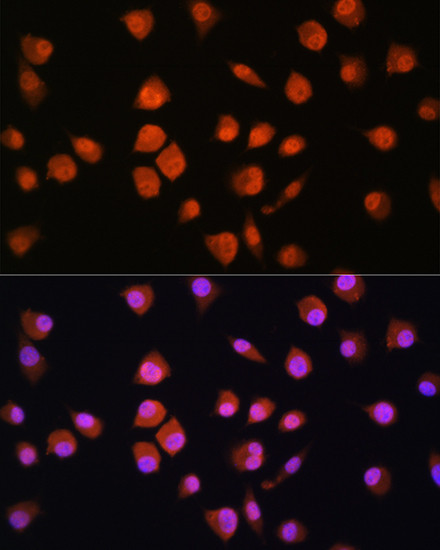 NPLOC4 Antibody in Immunocytochemistry (ICC/IF)