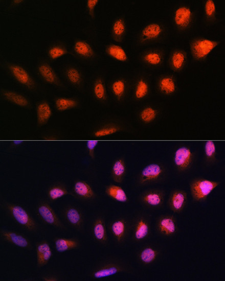 NPLOC4 Antibody in Immunocytochemistry (ICC/IF)