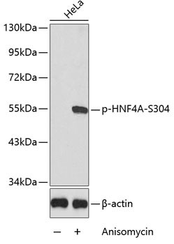 Phospho-HNF4A (Ser304) Antibody in Western Blot (WB)