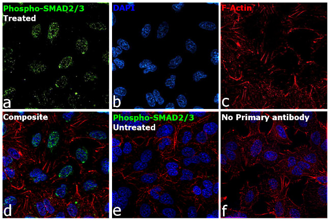 Phospho-SMAD2/SMAD3 (Ser465, Ser467, Ser423, Ser425) Antibody in Immunocytochemistry (ICC/IF)