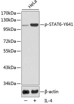 Phospho-STAT6 (Tyr641) Antibody in Western Blot (WB)