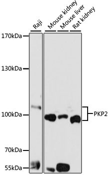 PKP2 Antibody in Western Blot (WB)