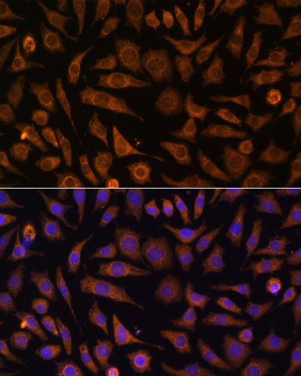 RAB1A Antibody in Immunocytochemistry (ICC/IF)