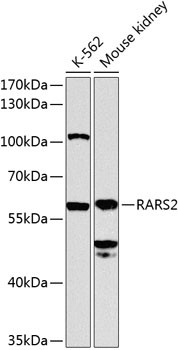 RARS2 Antibody in Western Blot (WB)