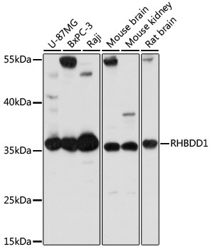 RHBDD1 Antibody in Western Blot (WB)