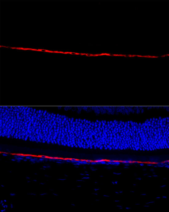 RPE65 Antibody in Immunocytochemistry (ICC/IF)