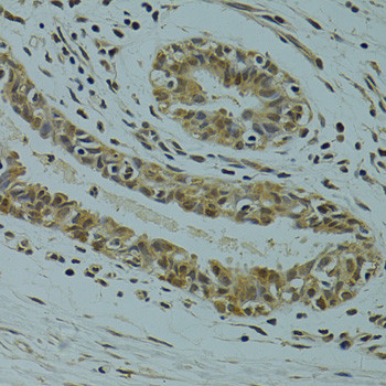 RSRC1 Antibody in Immunohistochemistry (Paraffin) (IHC (P))