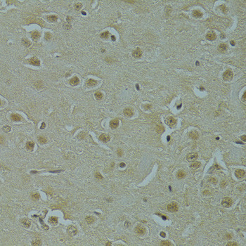 RSRC1 Antibody in Immunohistochemistry (Paraffin) (IHC (P))