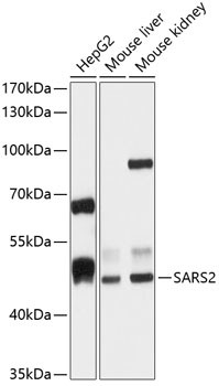 SARS2 Antibody in Western Blot (WB)