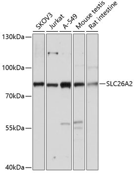 SLC26A2 Antibody in Western Blot (WB)