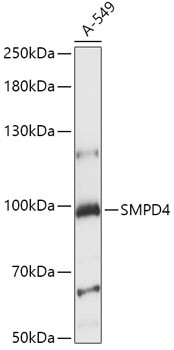 SMPD4 Antibody in Western Blot (WB)