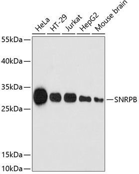 SNRPB Antibody in Western Blot (WB)
