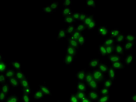 SOX5 Antibody in Immunocytochemistry (ICC/IF)