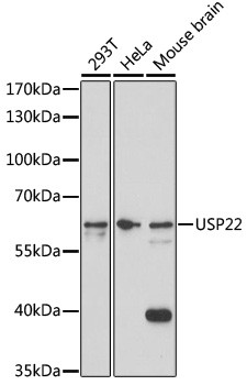 USP22 Antibody in Western Blot (WB)