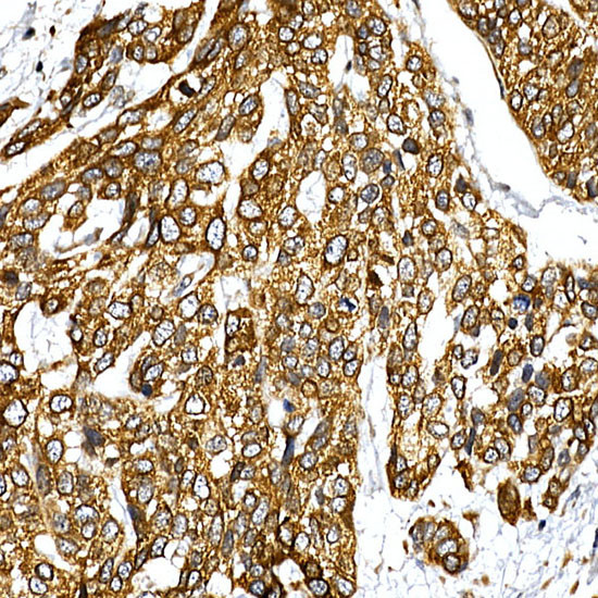 VAPB Antibody in Immunohistochemistry (Paraffin) (IHC (P))