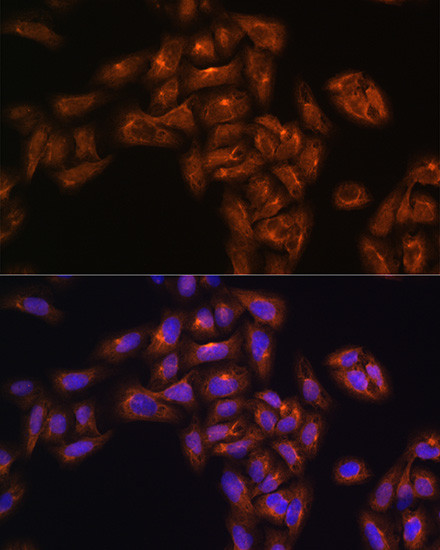 Alix Antibody in Immunocytochemistry (ICC/IF)