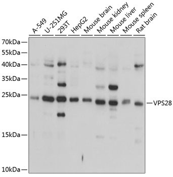 VPS28 Antibody in Western Blot (WB)