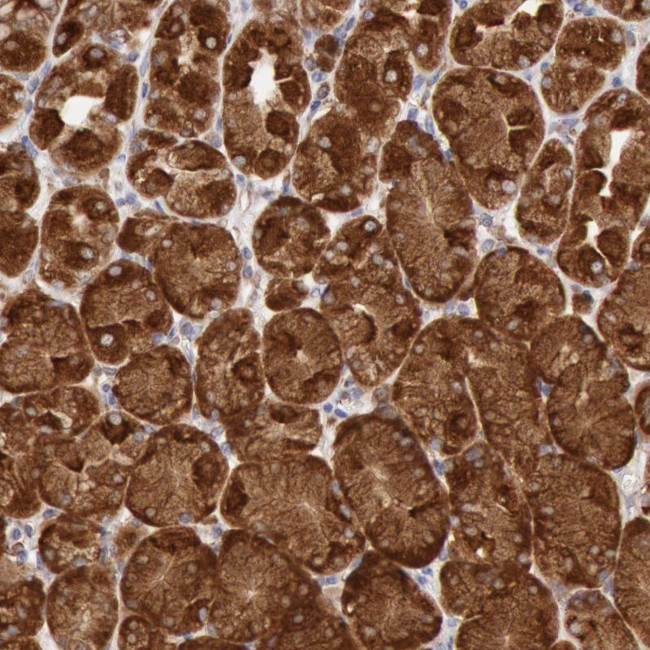 ERP44 Antibody in Immunohistochemistry (Paraffin) (IHC (P))