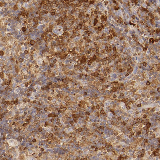 APOBEC3G Antibody in Immunohistochemistry (Paraffin) (IHC (P))