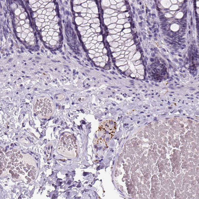 Dopamine beta Hydroxylase Antibody in Immunohistochemistry (Paraffin) (IHC (P))