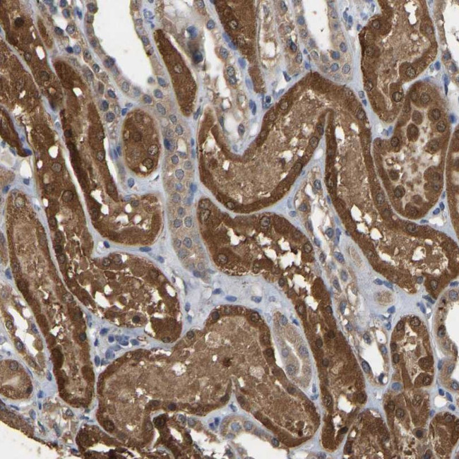 CIDEC Antibody in Immunohistochemistry (Paraffin) (IHC (P))