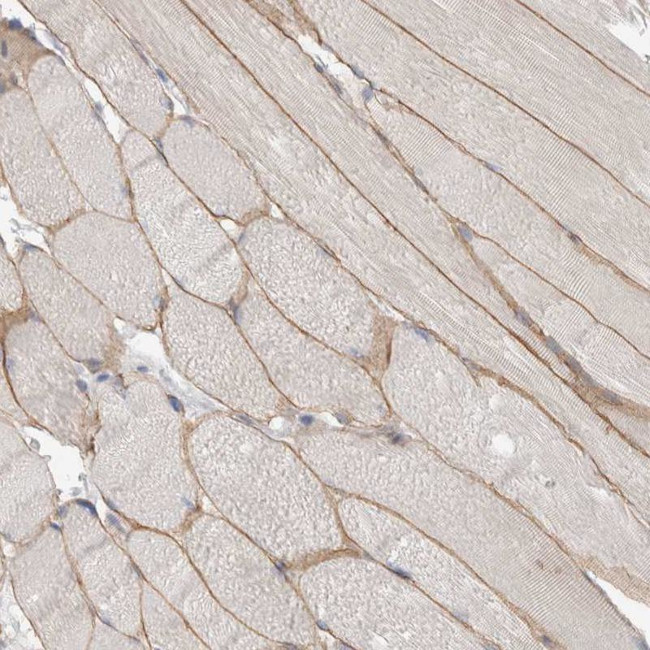 Dystrophin Antibody in Immunohistochemistry (Paraffin) (IHC (P))