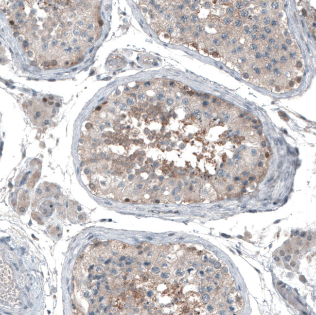 ABCC11 Antibody in Immunohistochemistry (Paraffin) (IHC (P))