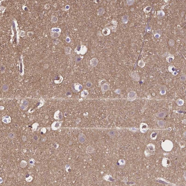 CRMP1 Antibody in Immunohistochemistry (Paraffin) (IHC (P))