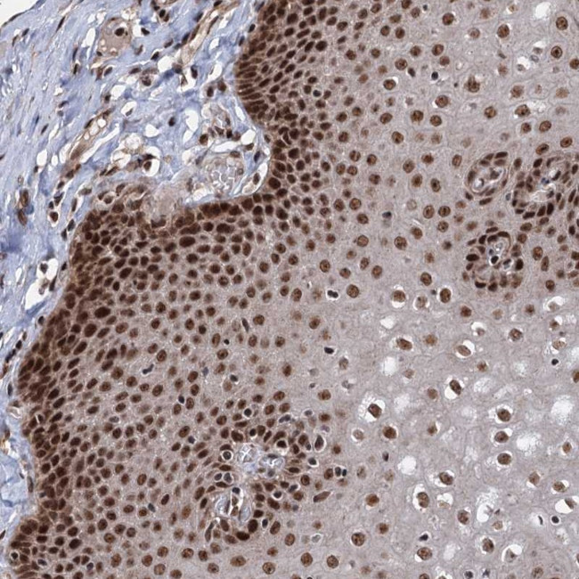 MAML1 Antibody in Immunohistochemistry (Paraffin) (IHC (P))